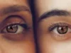 OJERAS Y BOLSAS EN LOS OJOS, ¿QUÉ SON Y CÓMO PREVENIRLAS? 