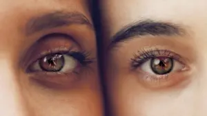 OJERAS Y BOLSAS EN LOS OJOS, ¿QUÉ SON Y CÓMO PREVENIRLAS?