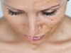 MITOS Y VERDADES SOBRE LAS MANCHAS EN EL ROSTRO 